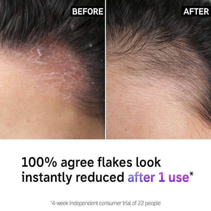 The Inkey List Exfoliating Scalp Treatment - 5 oz/150 ml