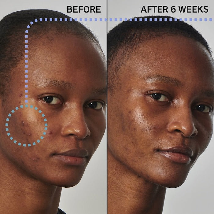 The Inkey List SuperSolutions Balance Skin Oil Serum - 1 oz /30 ml