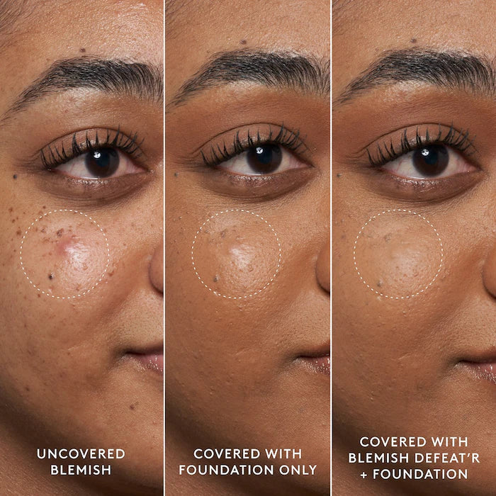 Fenty Blemish Defeat'r Spot-Targeting Gel 0.5 oz / 15 mL